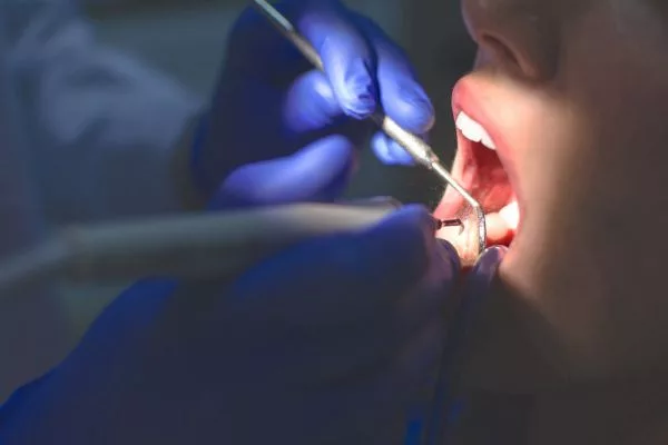 Best Dentist in Mumbai: Top Clinics, Reviews, and Services for Your Perfect Smile