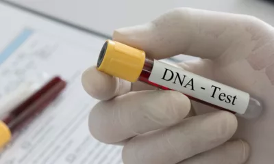 Cytogenetics vs Molecular Genetic Testing: Key Differences